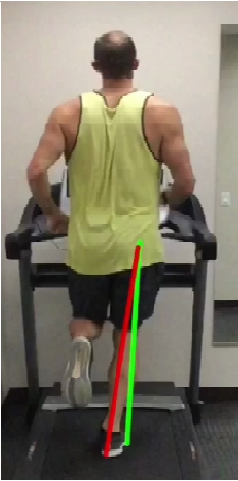 Running Gait Analysis Cross Over Gait