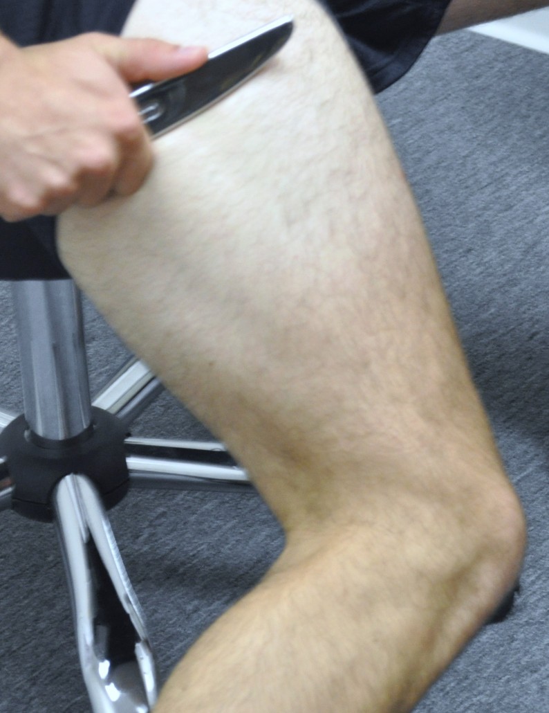 Iliotibial Band Syndrome Treatment Graston San Diego