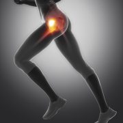 Hip pain running doctor San Diego