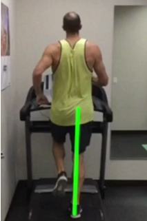 Gait Analysis San Diego