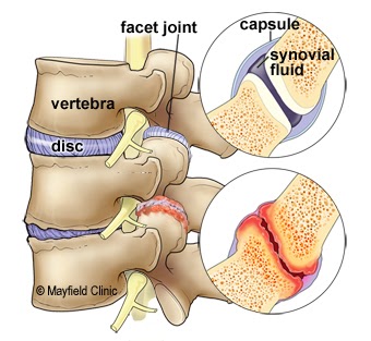 zygapophyseal joint)