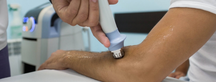 Shockwave therapy for tennis elbow san diego