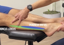 Peroneal tendonitis treatment san diego
