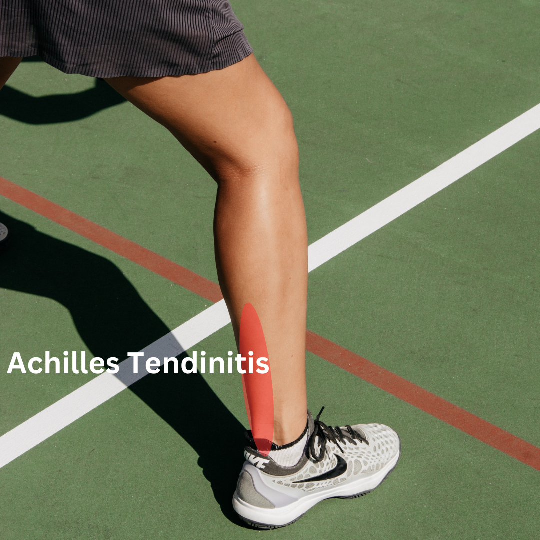 Achilles Strengthening Exercises - Equilibrium Sports and Spinal Clinic